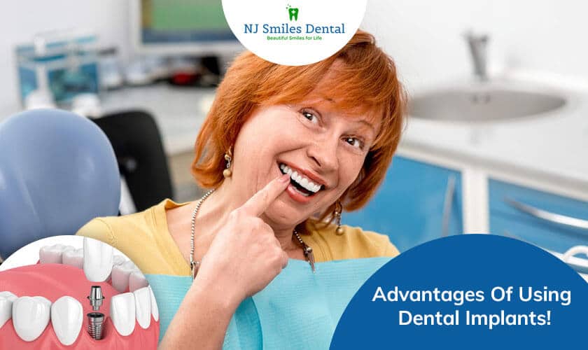 Featured image for “Advantages Of Using Dental Implants!”