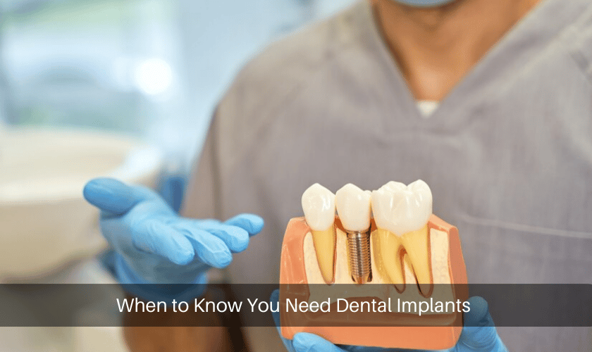 When to Know You Need Dental Implants