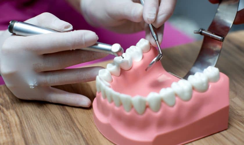 Guide To Navigating The Dental Implant Process
