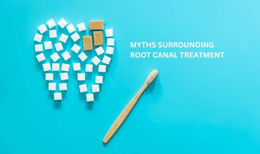 Featured image for “Top 10 Myths Surrounding Root Canal Treatment”