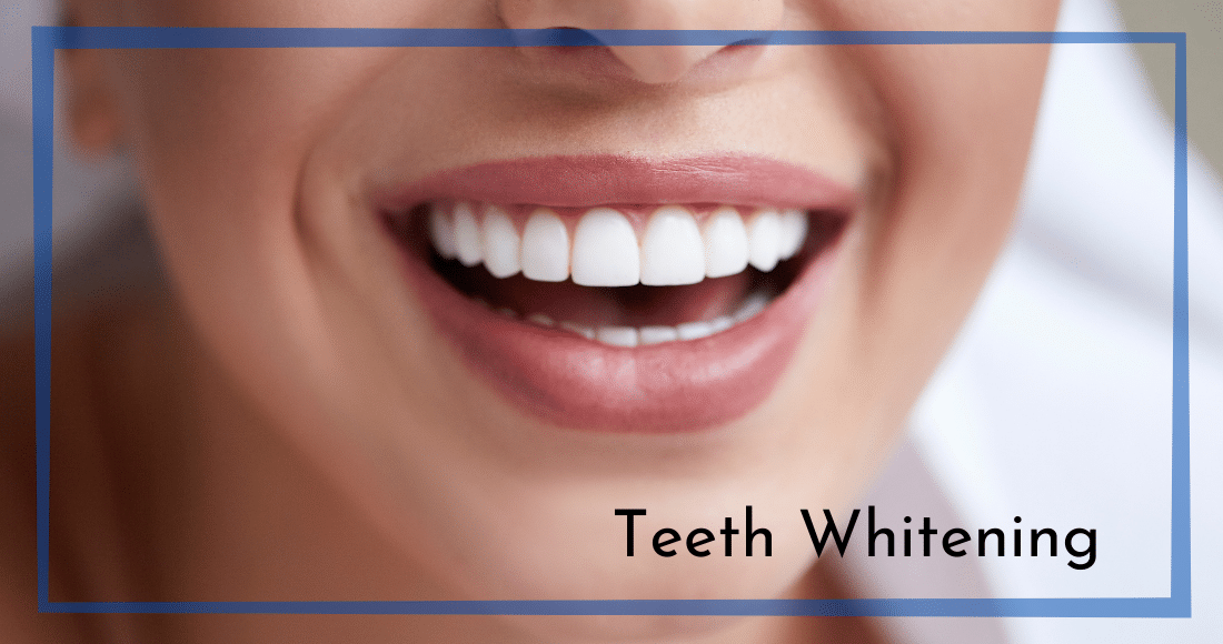 Featured image for “Beyond the Brush: Unleashing the Secrets to Dazzling Teeth Whitening”