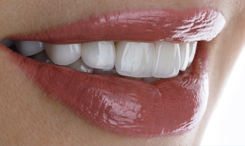 Featured image for “How Can a Cosmetic Dentist Fix Your Teeth?”